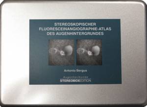 Cover zu Stereoskopischer Fluoresceinangiographie-Atlas des Augenhintergrundes (ISBN 9783826048586)